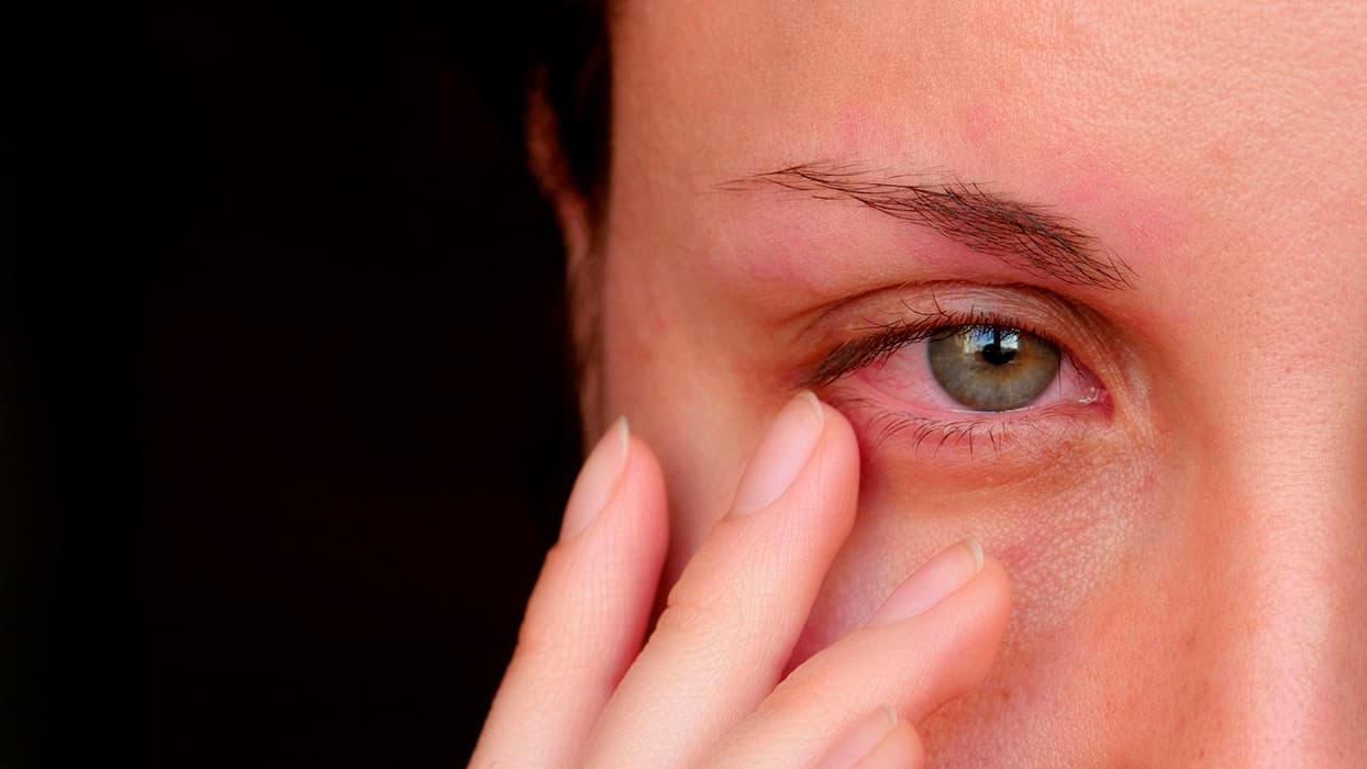 Enfermedades de los ojos